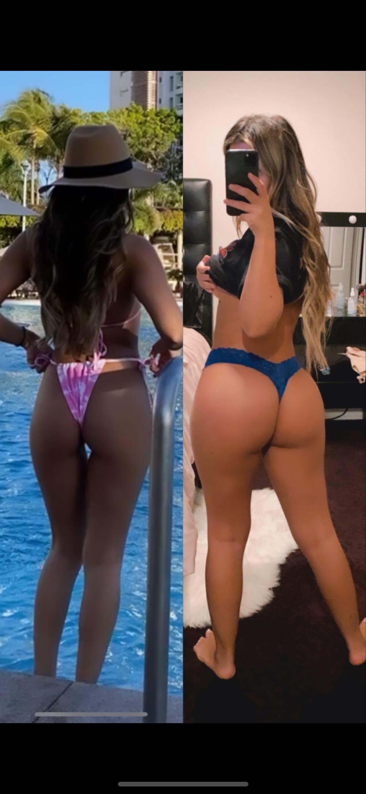 Real patient before and after Brazilian Butt Lift (BBL) showing enhanced curves and gluteal projection at Vive Plastic Surgery Tijuana