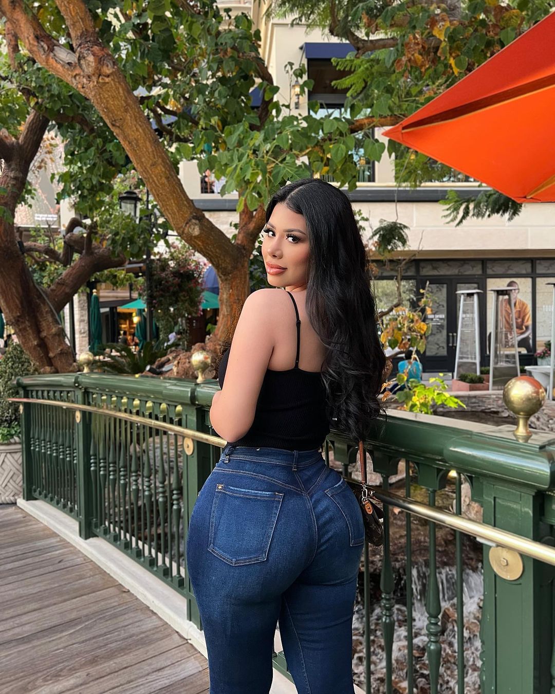 Real patient after Brazilian Butt Lift (BBL) showing natural volume and defined curves at Vive Plastic Surgery Tijuana